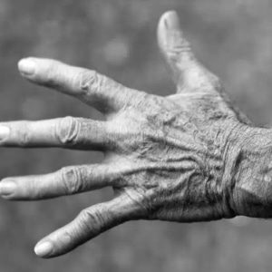 Hand creams for damaged hands